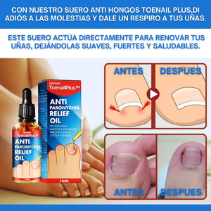 HONGOS TOENAIL PLUS - GOTERO
