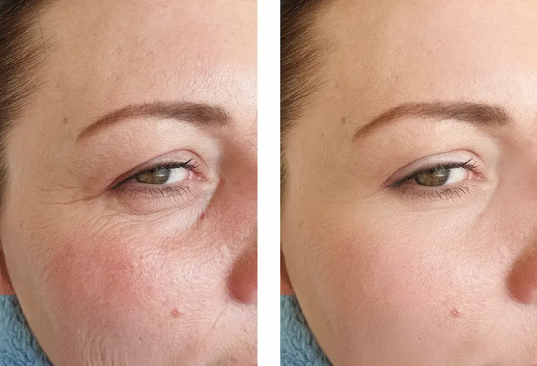 Tónico retinol bioaqua
