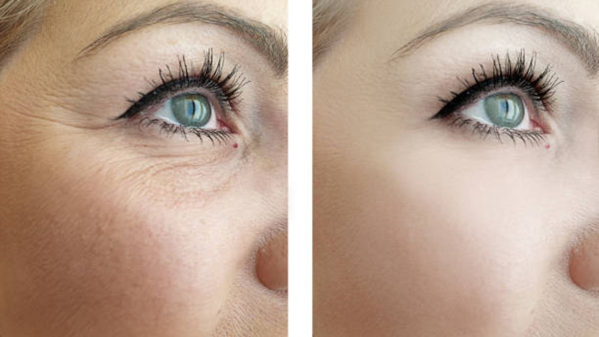 Contorno de Ojos de Aguacate y Retinol